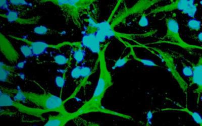 Stem cells help untangle Alzheimer’s, other disease origins