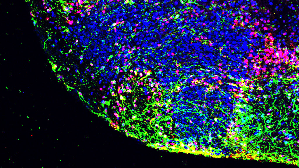 Discovering pathways for neural development